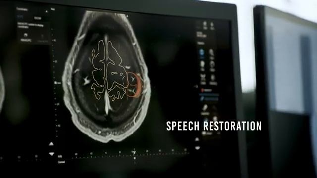 Магия управления мыслью: Как Neuralink возвращает независимость людям. Озвучено нейросетью