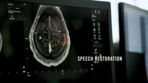 Магия управления мыслью: Как Neuralink возвращает независимость людям. Озвучено нейросетью