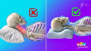 Боль против сна. Жить здорово! Фрагмент выпуска от 17.04.2026