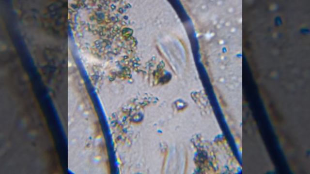 инфузории в панике