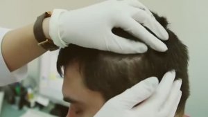 Школа здоровья. Перхоть