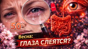 Почему весной страдают глаза? Зрение и кишечник. Связь есть!