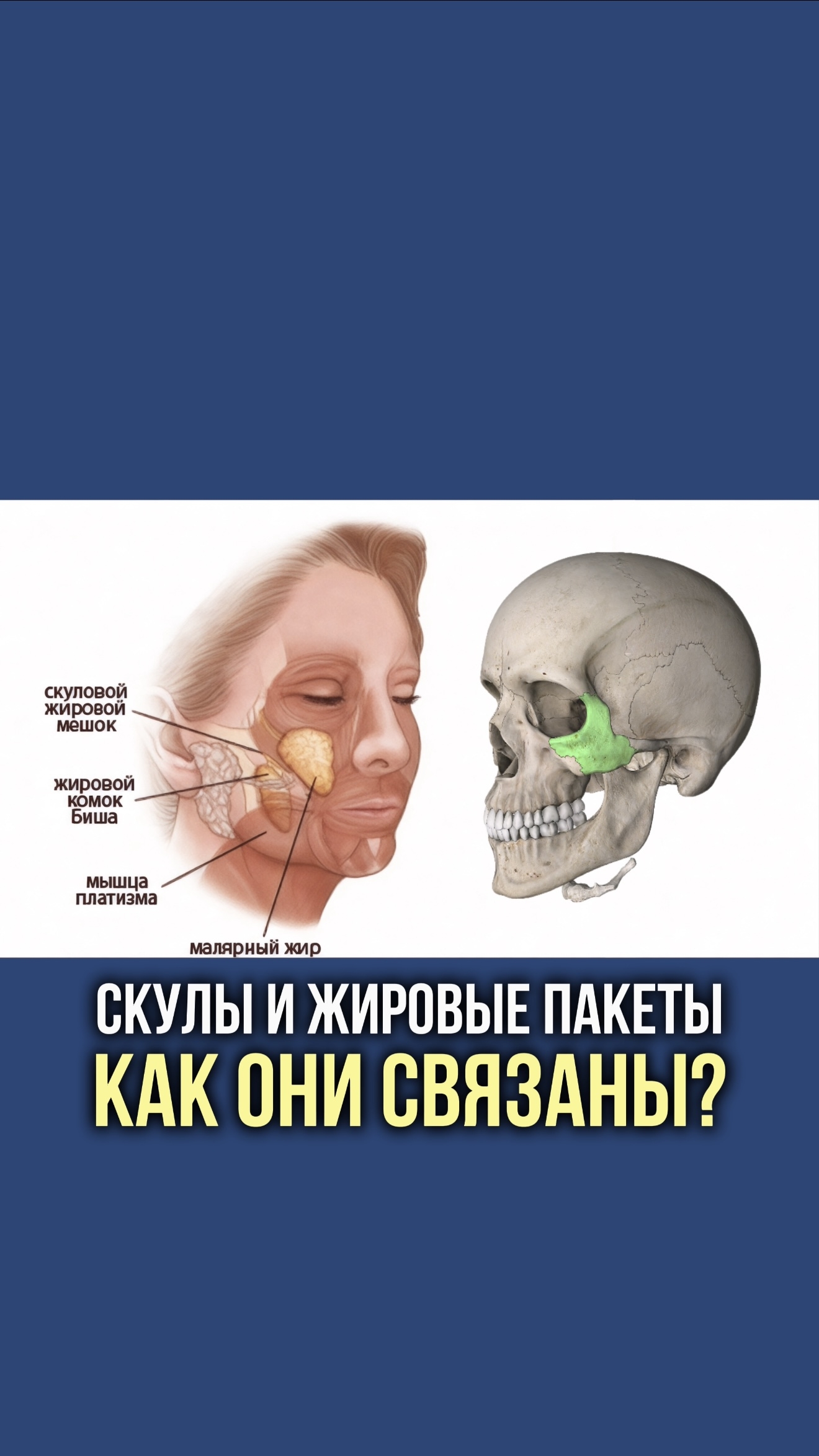 Скулы и жировые пакеты.  Как они связаны?