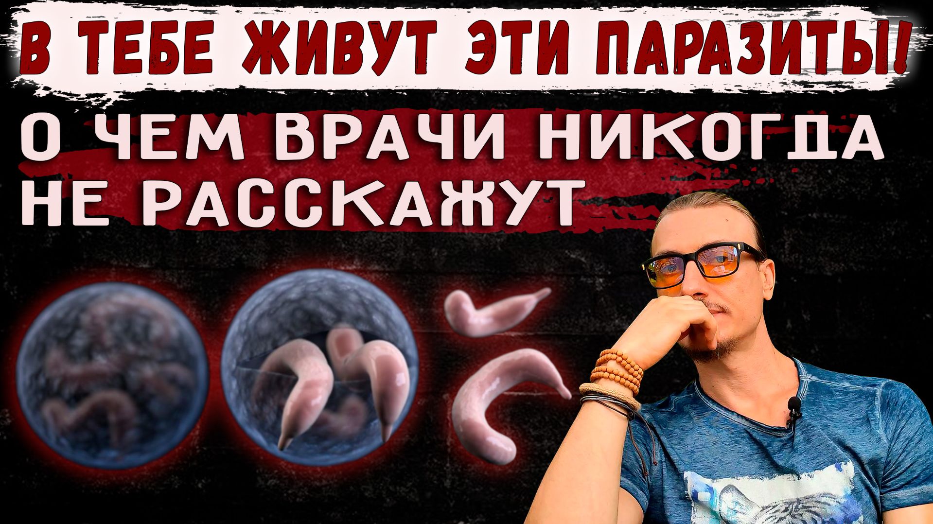 В тебе живут эти паразиты! О чем врачи никогда не расскажут