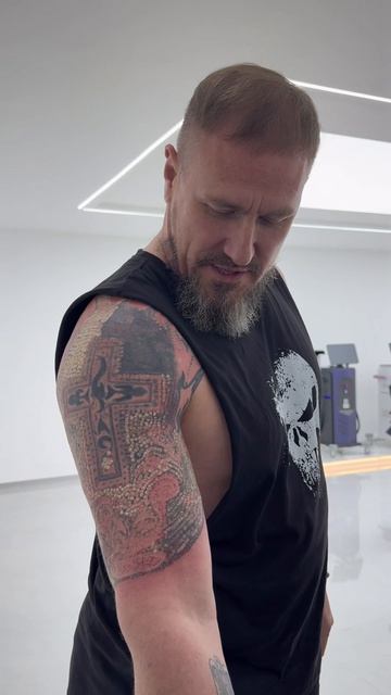 Лазер для удаления тату