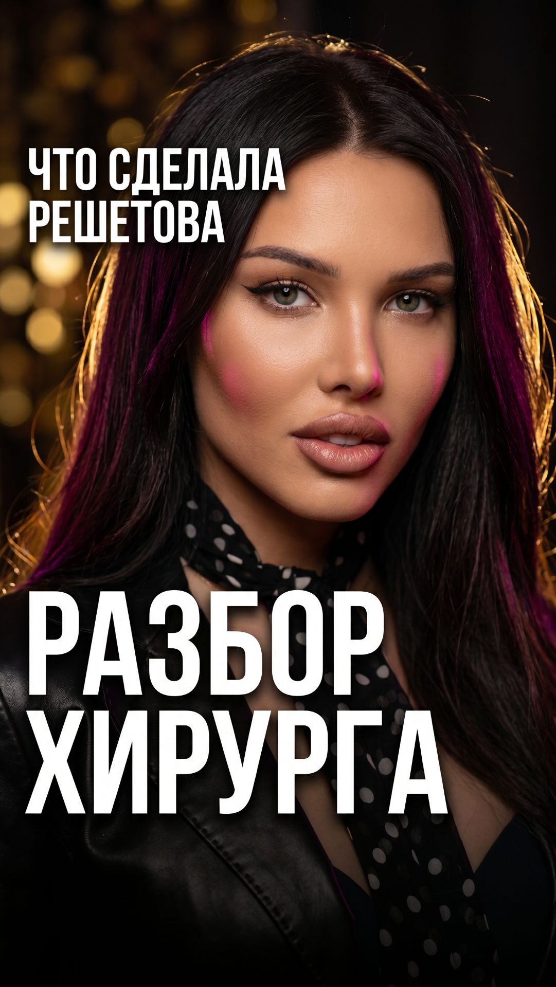 Ринопластика, Биша, лисьи глаза, маммопластика — разбираю что сделала Решетова по пунктам 👇