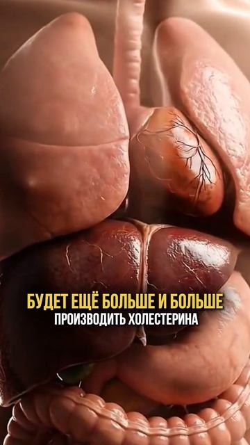 Высокий холестерин? Есть решение!