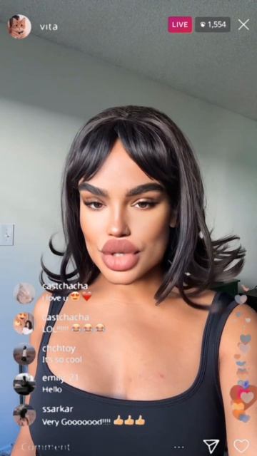 Сделала губы 👄