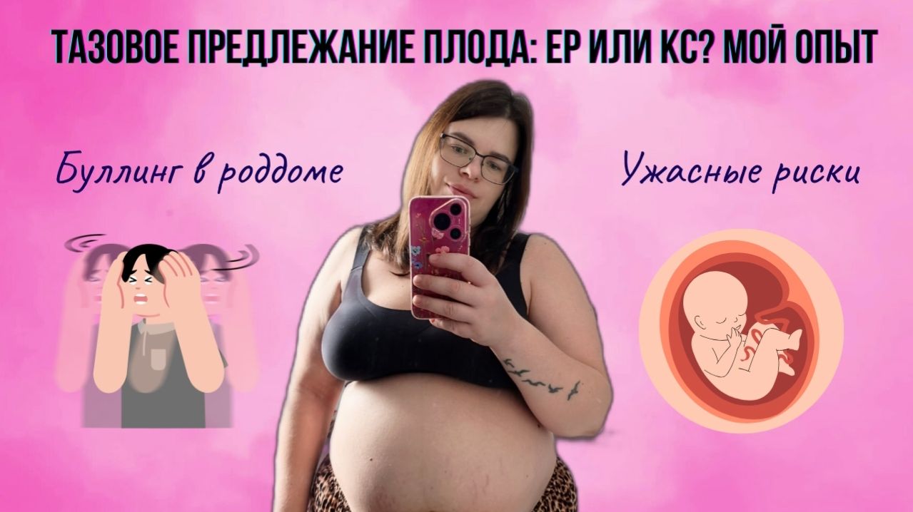 Мои роды. Часть 1. Тазовое предлежание плода