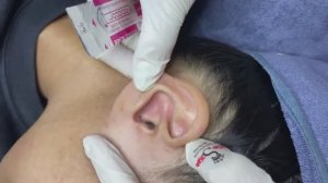 077 • Acne collection • АСМР • Relax Spa