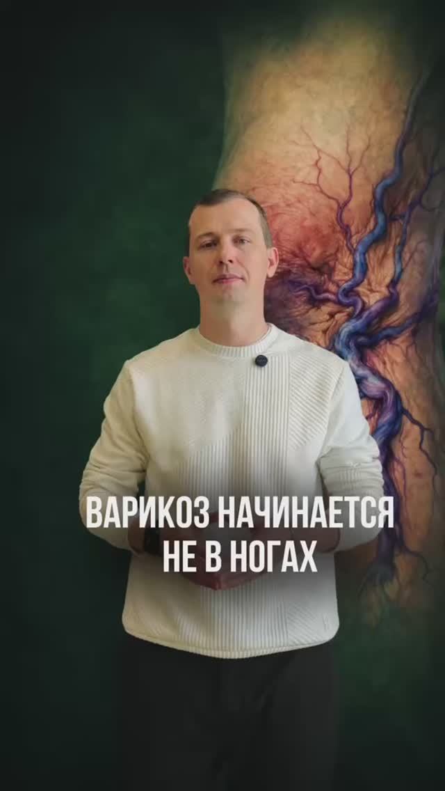 Вы правда думаете, что варикоз начинается в ногах? 👣