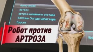 Робот лечит колено: Лазер BTL в «Гиппократе» (ст. Ленинградская) ⚡️🦾