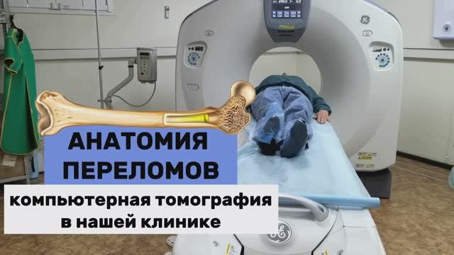 Зачем делать КТ при переломе? Современная диагностика в МЦ «Гиппократ» | ст. Ленинградская