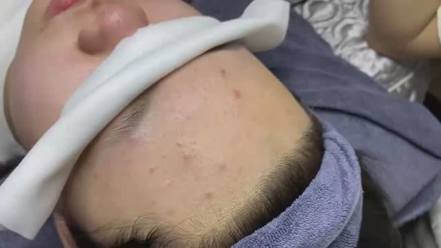 088 • Acne collection • АСМР • Relax Spa