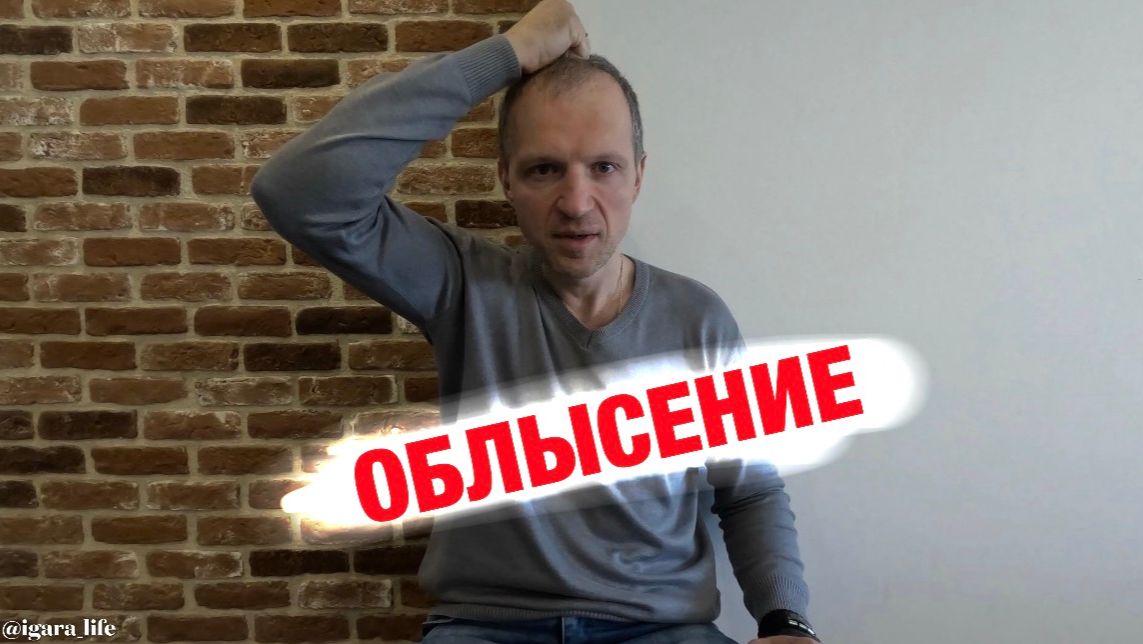 Облысение: Проверь себя за 30 секунд (Тест в видео).