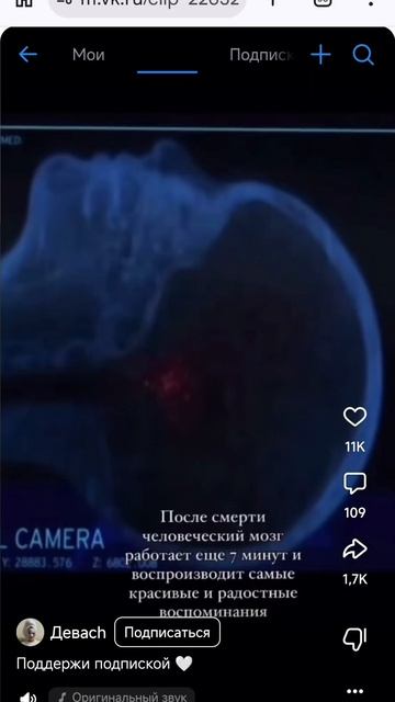 Это не шутки, я не могу ничего нормально делать...