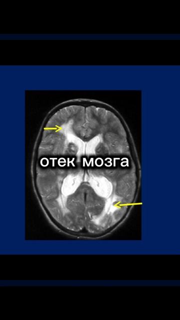 из за чего умерли императоры России