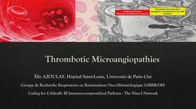Thrombotic Microangiopathies Elie Azoulay ISICEM 45
