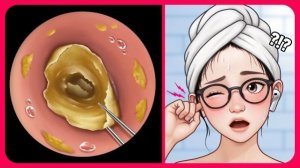 АСМР: ФУ, НУ И ГАДОСТЬ! 🤢ЧТО МОЖЕТ БЫТЬ В УШНОЙ РАКОВИНЕ!!