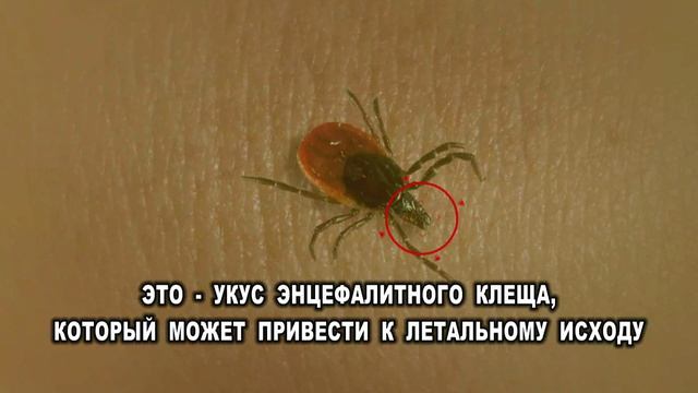 МЧС - про клещей (15 сек)