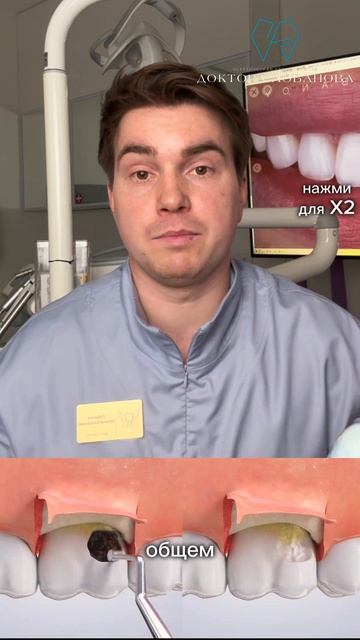 Не удаляйте разрушенный зуб, даже если он сильно разрушен