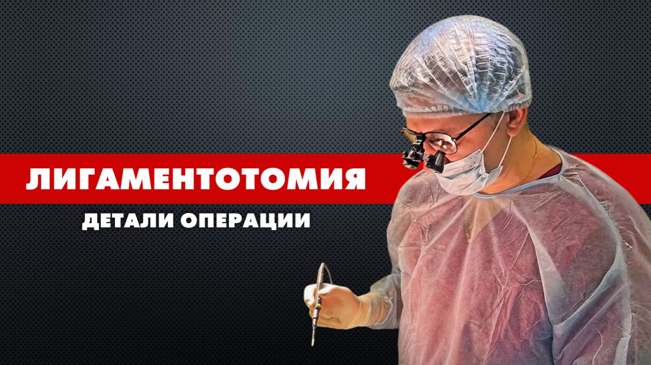 Лигаментотомия: операция, детали