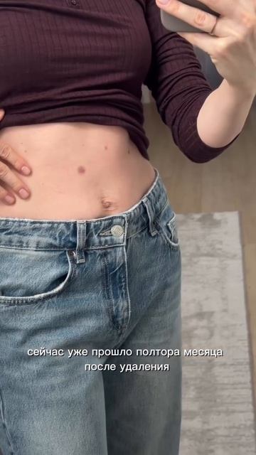 Удаление родинок — это не страшно, если процедура проводится правильно и под контролем врача 🤍