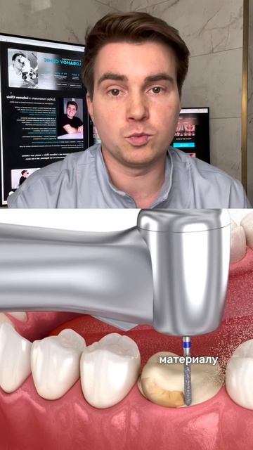 Не удаляйте зуб, даже если он так сильно разрушен.