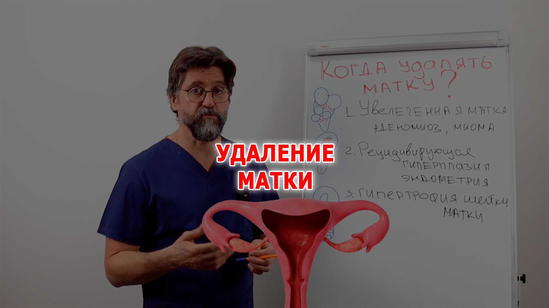 Когда удалять матку при опущении?