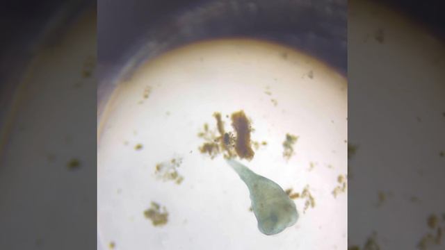 Инфузория - трубач в речной воде