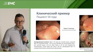 5 Ликутов АА Эндоскопическая семиотика генетич детерминированных образ кишки: от генотипа к фенотипу