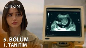 «Дурнушка» 5 серия обзор