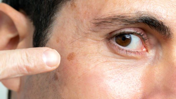 САМЫЙ ПОЗНАВАТЕЛЬНЫЙ КАНАЛ. ВСЁ О РАКЕ ПРОСТАТЫ.