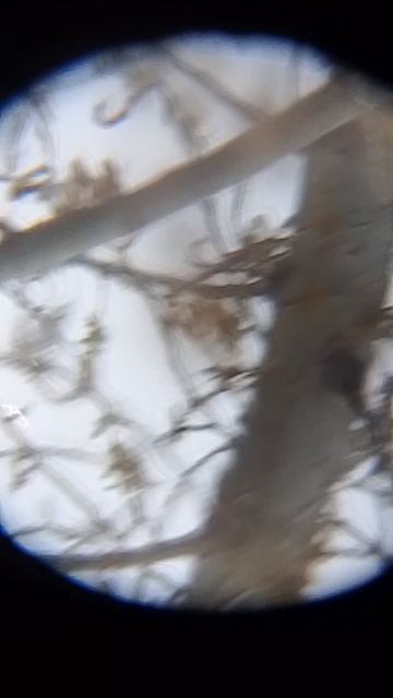 деревья и телескоп