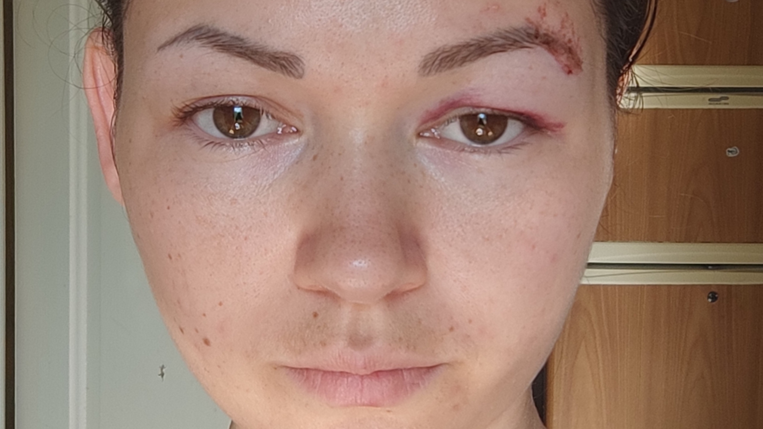 Восстанавливаюсь