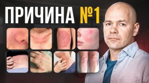 Вы лечите не то! Почему лечение проблем с кожей не даёт стойкого результата?