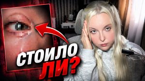 Я СДЕЛАЛА ОПЕРАЦИЮ НА ГЛАЗА… Стоило ли это того? | Что происходит во время операции (FemtoLasik)