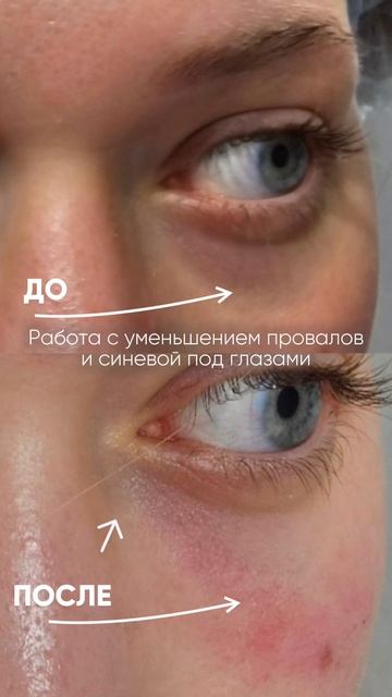 ВЫБРОСИТЬ КОНСИЛЕР! Эффект «выспавшегося лица»ВЫБРОСЬТЕ