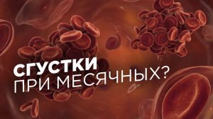 Почему появляются сгустки при месячных (3 главные причины)