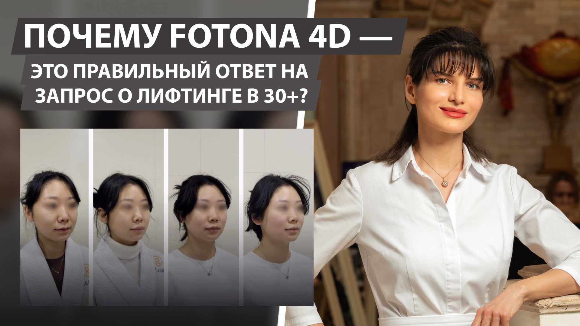 Почему Fotona 4D — это правильный ответ на запрос о лифтинге в 30+?