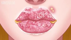 05 • мульт АСМР • Исправление коррекции губ у королевы