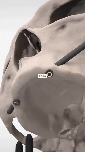 Вот что произойдет, если не восстановить утраченный зуб в течение полугода