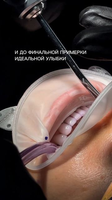 Что стоит за Вашей улыбкой?