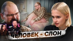 «Ношу на себе 80 кг» _ Слоновья болезнь _ РЕАКЦИЯ