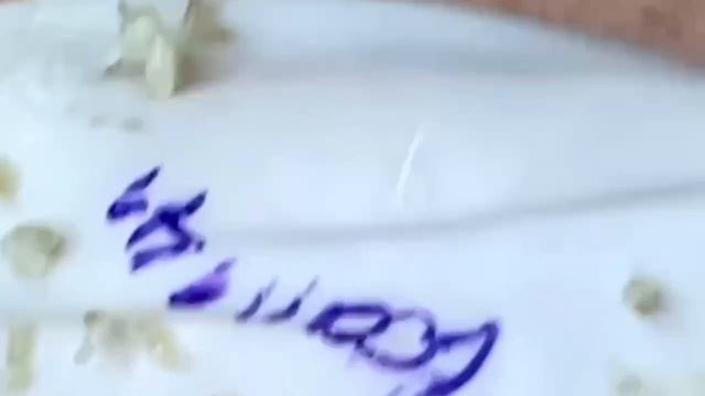 #279 Чистка лица от угрей и акне. Выдавливание прыщей. Удаление черных точек и комедонов