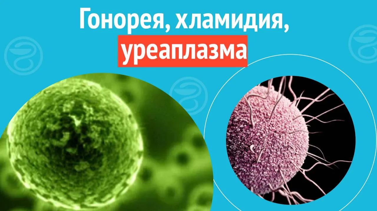 😦 Гонорея, хламидия, уреаплазма и гарднерелла. Клинический случай №1281