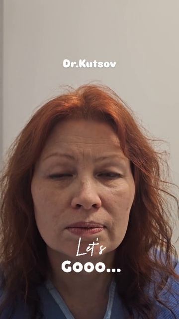 Результат всего через месяц после операции 

Открытый свежий взгляд



#блефаропластика 
#Сахалин
#б