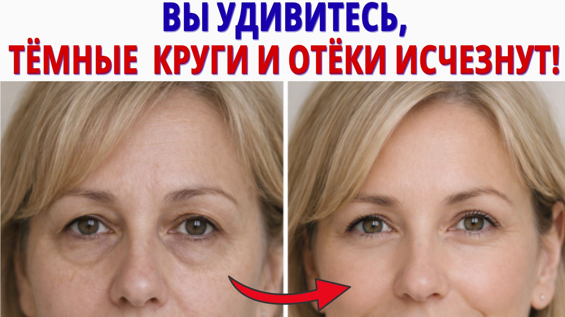 Как УБРАТЬ тёмные КРУГИ и ОТЁКИ ПОД ГЛАЗАМИ за 5 минут? Лимфодренаж, который работает после 50