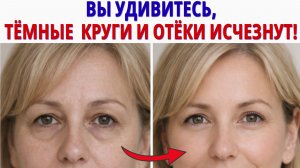 Как УБРАТЬ тёмные КРУГИ и ОТЁКИ ПОД ГЛАЗАМИ за 5 минут? Лимфодренаж, который работает после 50