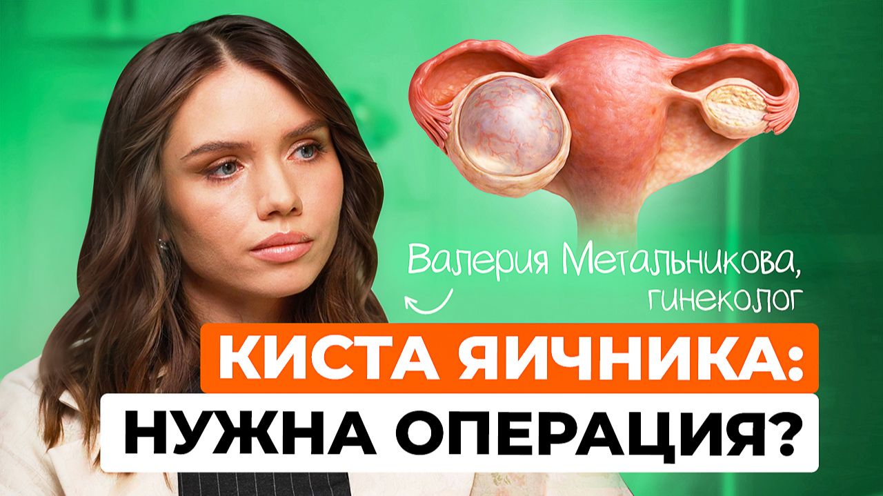 Киста яичника: симптомы и когда без операции не обойтись
